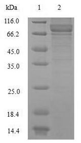 NNMT Protein - (Tris-Glycine gel) Discontinuous SDS-PAGE (reduced) with 5% enrichment gel and 15% separation gel.