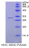 NNMT Protein - Recombinant Nicotinamide-N-Methyltransferase By SDS-PAGE