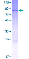 NOB1 / NOB1P Protein - 12.5% SDS-PAGE of human NOB1 stained with Coomassie Blue