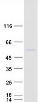 NOB1 / NOB1P Protein - Purified recombinant protein NOB1 was analyzed by SDS-PAGE gel and Coomassie Blue Staining