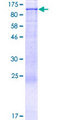 NOC2L Protein - 12.5% SDS-PAGE of human NOC2L stained with Coomassie Blue