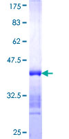 NOC3L Protein - 12.5% SDS-PAGE Stained with Coomassie Blue.