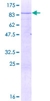 NOC4L Protein - 12.5% SDS-PAGE of human NOC4L stained with Coomassie Blue