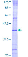 NOD1 Protein - 12.5% SDS-PAGE Stained with Coomassie Blue.