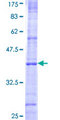 NOD1 Protein - 12.5% SDS-PAGE Stained with Coomassie Blue.