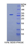 NOD1 Protein - Recombinant Nucleotide Binding Oligomerization Domain Containing Protein 1 By SDS-PAGE