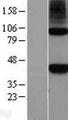 NODAL Protein - Western validation with an anti-DDK antibody * L: Control HEK293 lysate R: Over-expression lysate