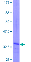 NODAL Protein - 12.5% SDS-PAGE Stained with Coomassie Blue.
