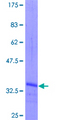 NODAL Protein - 12.5% SDS-PAGE Stained with Coomassie Blue.