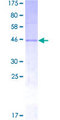 NOG / Noggin Protein - 12.5% SDS-PAGE of human NOG stained with Coomassie Blue