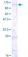 NOL10 Protein - 12.5% SDS-PAGE of human NOL10 stained with Coomassie Blue