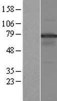NOL4 Protein - Western validation with an anti-DDK antibody * L: Control HEK293 lysate R: Over-expression lysate