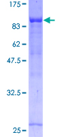 NOL4 Protein - 12.5% SDS-PAGE of human NOL4 stained with Coomassie Blue