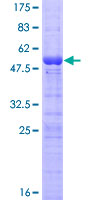 NOL5A / NOP56 Protein - 12.5% SDS-PAGE of human NOL5A stained with Coomassie Blue