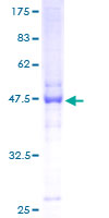 NOL6 / NRAP Protein - 12.5% SDS-PAGE of human NOL6 stained with Coomassie Blue