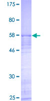 NOL7 / RARG-1 Protein - 12.5% SDS-PAGE of human NOL7 stained with Coomassie Blue