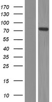 NOL9 Protein - Western validation with an anti-DDK antibody * L: Control HEK293 lysate R: Over-expression lysate