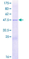 NOLA2 Protein - 12.5% SDS-PAGE of human NOLA2 stained with Coomassie Blue