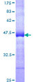 NOLC1 Protein - 12.5% SDS-PAGE Stained with Coomassie Blue.