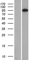 NOM1 Protein - Western validation with an anti-DDK antibody * L: Control HEK293 lysate R: Over-expression lysate