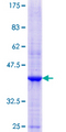 NOMO1 / PM5 Protein - 12.5% SDS-PAGE Stained with Coomassie Blue.