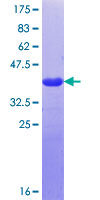 NOMO3 Protein - 12.5% SDS-PAGE Stained with Coomassie Blue.