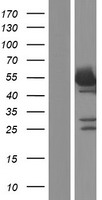 NONO / P54NRB Protein - Western validation with an anti-DDK antibody * L: Control HEK293 lysate R: Over-expression lysate
