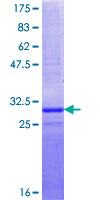 NOP10 Protein - 12.5% SDS-PAGE Stained with Coomassie Blue.