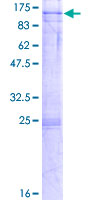 NOP14 / C4orf9 Protein - 12.5% SDS-PAGE of human NOL14 stained with Coomassie Blue