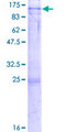 NOP14 / C4orf9 Protein - 12.5% SDS-PAGE of human NOL14 stained with Coomassie Blue