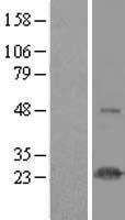 NOP16 Protein - Western validation with an anti-DDK antibody * L: Control HEK293 lysate R: Over-expression lysate