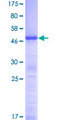 NOP16 Protein - 12.5% SDS-PAGE of human HSPC111 stained with Coomassie Blue