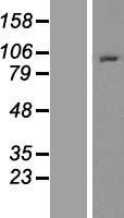 NOP2 Protein - Western validation with an anti-DDK antibody * L: Control HEK293 lysate R: Over-expression lysate