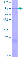 NOP58 / NOP5 Protein - 12.5% SDS-PAGE of human NOP5/NOP58 stained with Coomassie Blue