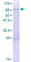NOP9 Protein - 12.5% SDS-PAGE of human C14orf21 stained with Coomassie Blue