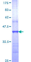 Nor-1 / NR4A3 Protein - 12.5% SDS-PAGE Stained with Coomassie Blue.