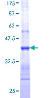 NOS1 / nNOS Protein - 12.5% SDS-PAGE Stained with Coomassie Blue.