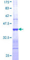 NOS1 / nNOS Protein - 12.5% SDS-PAGE Stained with Coomassie Blue.