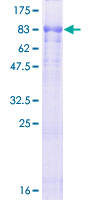 NOS1AP / CAPON Protein - 12.5% SDS-PAGE of human NOS1AP stained with Coomassie Blue