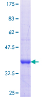 NOS1AP / CAPON Protein - 12.5% SDS-PAGE Stained with Coomassie Blue.