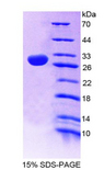 NOS1AP / CAPON Protein - Recombinant Nitric Oxide Synthase 1 Adaptor Protein By SDS-PAGE