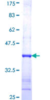 NOS2 / iNOS Protein - 12.5% SDS-PAGE Stained with Coomassie Blue.