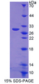 NOS2 / iNOS Protein - Recombinant  Nitric Oxide Synthase 2, Inducible By SDS-PAGE