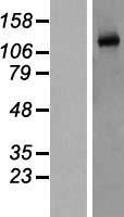 NOS3 / eNOS Protein - Western validation with an anti-DDK antibody * L: Control HEK293 lysate R: Over-expression lysate