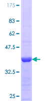 NOS3 / eNOS Protein - 12.5% SDS-PAGE Stained with Coomassie Blue.