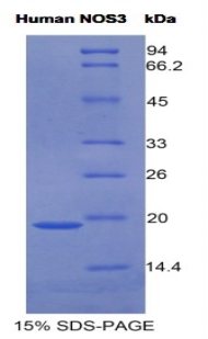 NOS3 / eNOS Protein - Recombinant  Nitric Oxide Synthase 3, Endothelial By SDS-PAGE