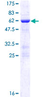 NOSIP Protein - 12.5% SDS-PAGE of human NOSIP stained with Coomassie Blue