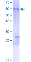NOSTRIN Protein - 12.5% SDS-PAGE of human NOSTRIN stained with Coomassie Blue
