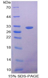 NOSTRIN Protein - Recombinant Nitric Oxide Synthase Trafficker By SDS-PAGE