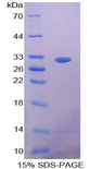 NOSTRIN Protein - Recombinant Nitric Oxide Synthase Trafficker By SDS-PAGE